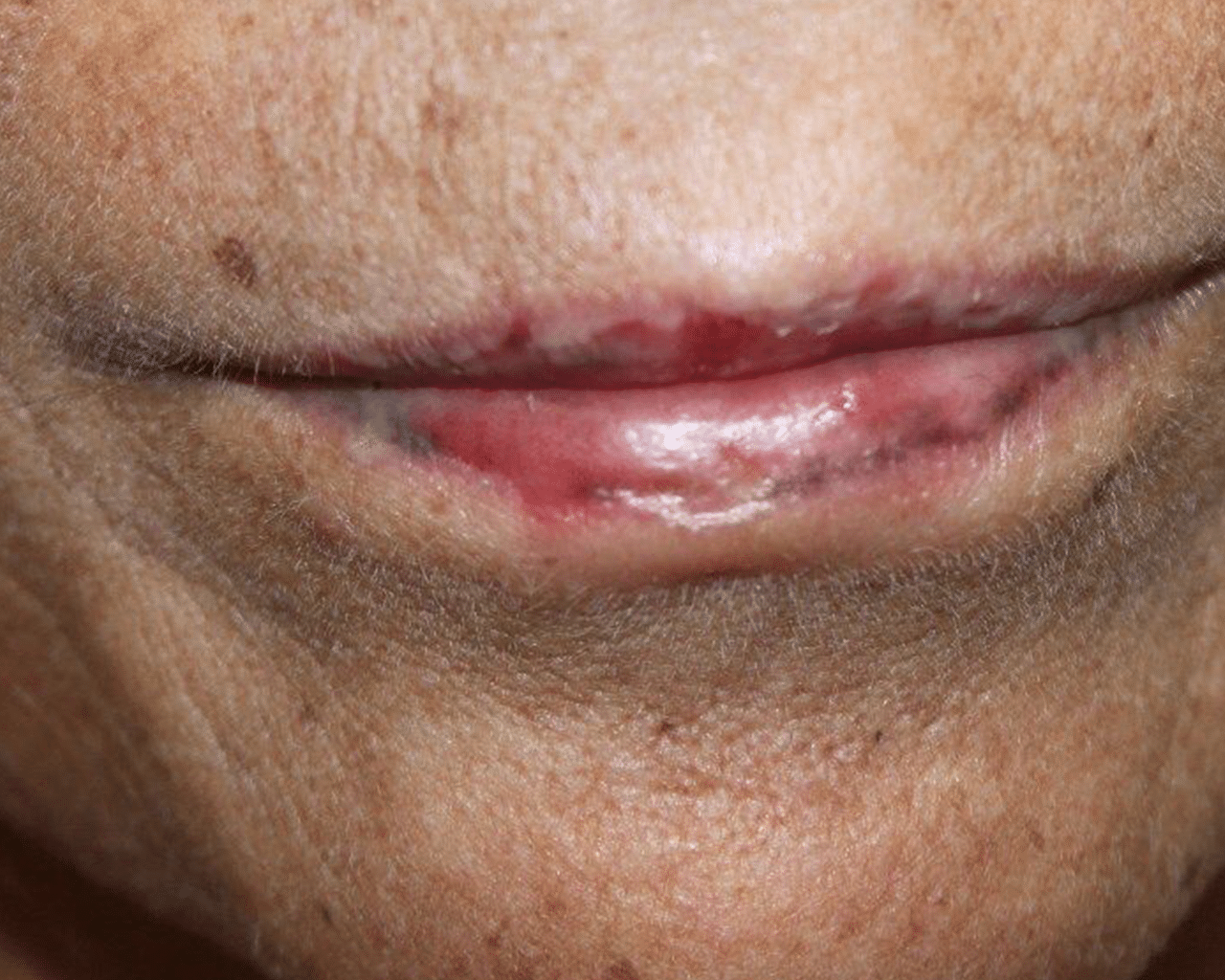 CellDerma Addisons Up Close Face Content Image