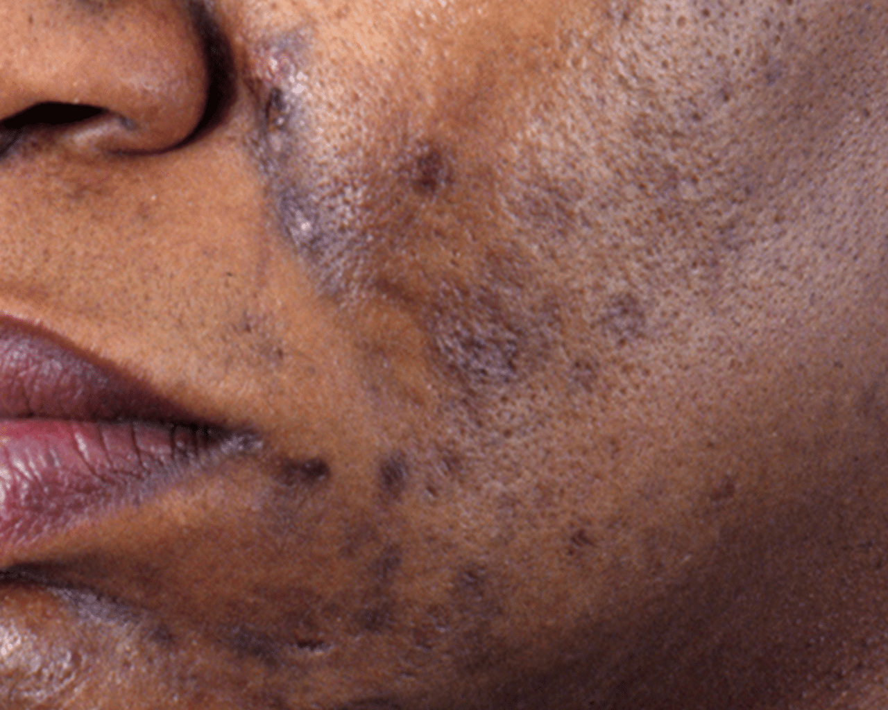 CellDerma Pigmentation Up Close Face Content Image