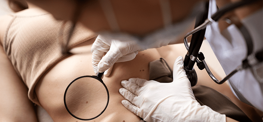 CellDerma Ladies Back Mole Check Up Magnifying Glass Doctor Close Up Content Image