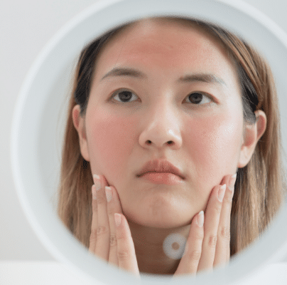 CellDerma Woman Irritated Skin Model Mirror Content Image