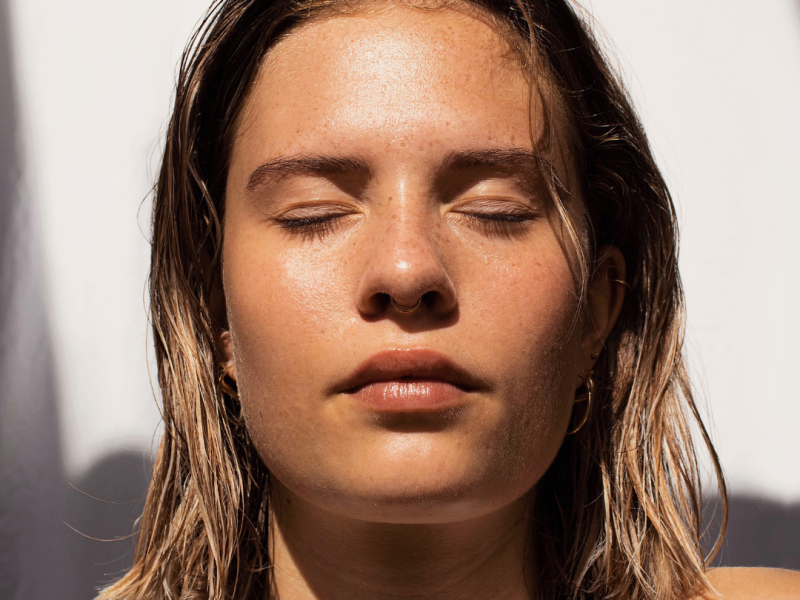 Sun, Sweat and Summer Acne