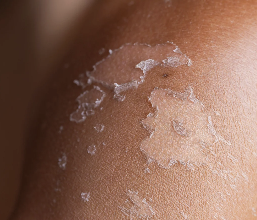 CellDerma Sun Damage Skin Close Up Content Image