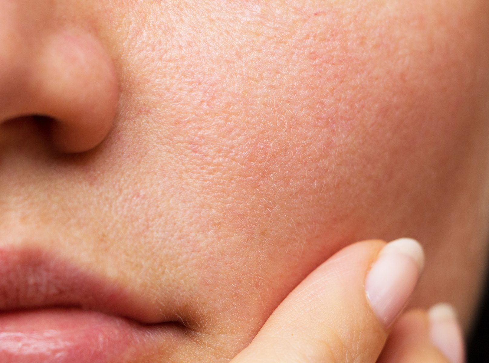 CellDerma Skin Close Up Pores on Face Content Image