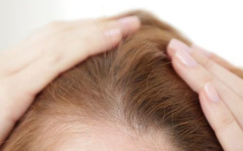 woman touching hair on head hair loss